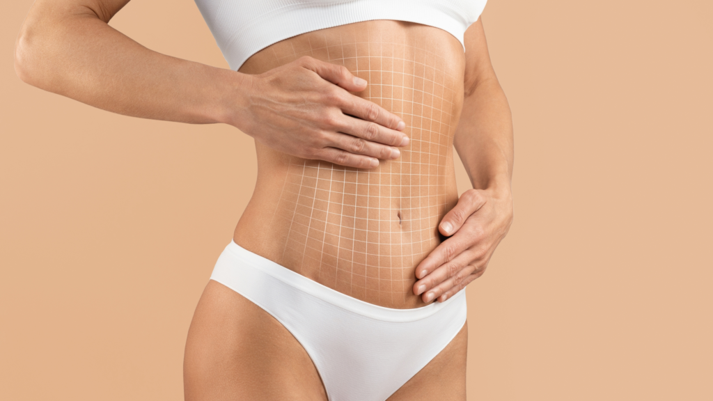 The Complete Guide to Tummy Tuck Procedures in Salt Lake City
